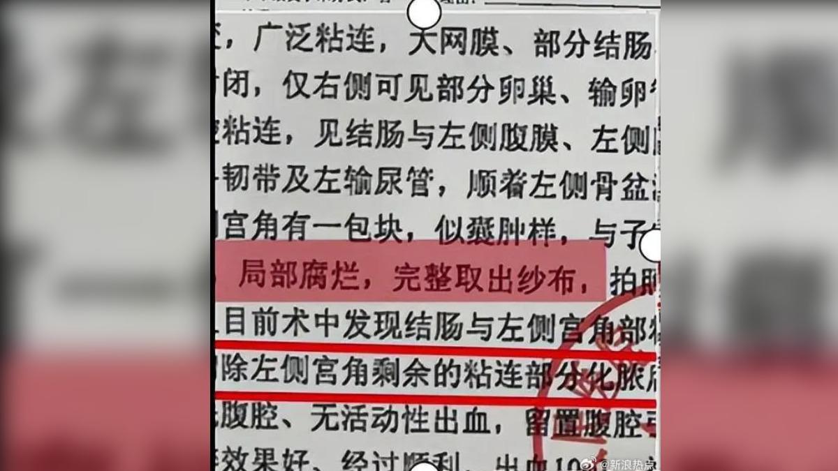 2023年因局部腐爛，被迫切除輸卵管。（圖／翻攝自微博）