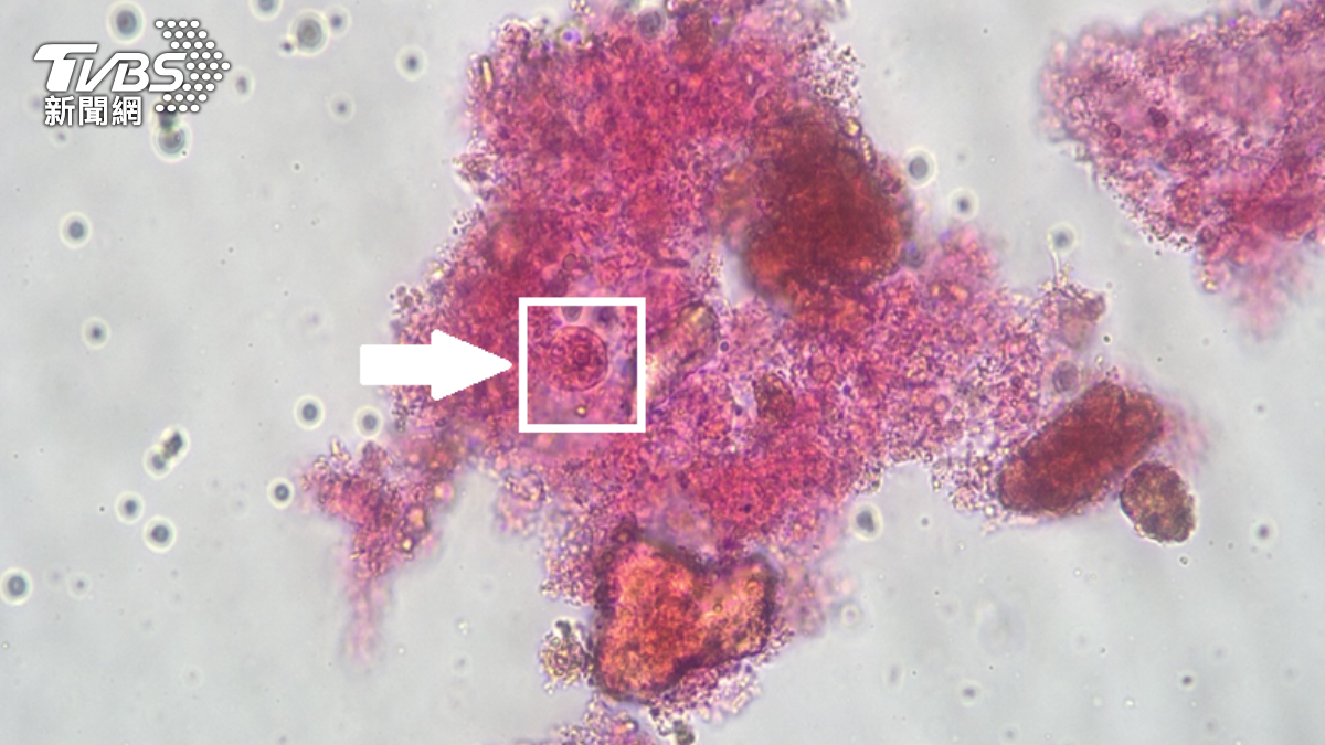 糞便一驗揪出阿米巴原蟲。（圖／TVBS）