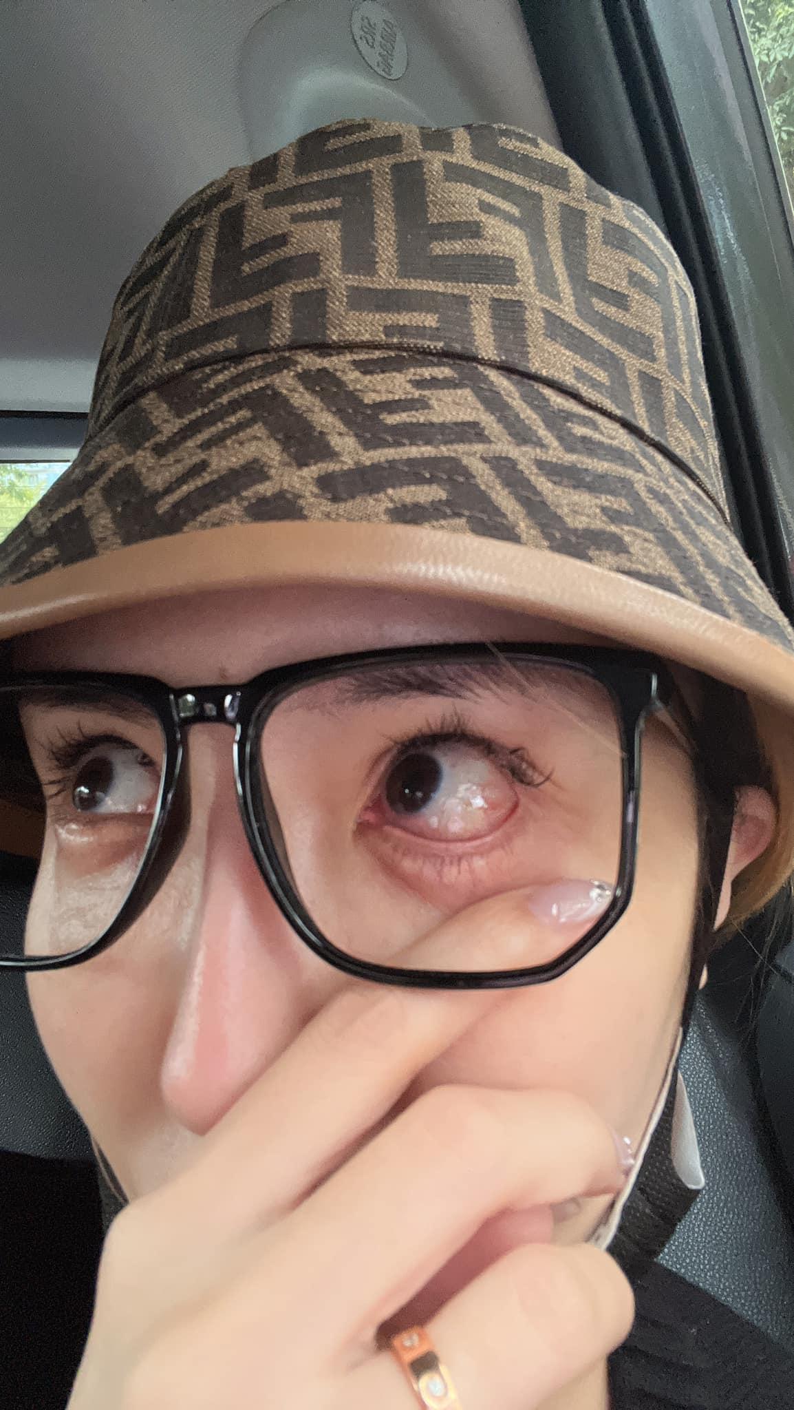 雪碧發文分享整形後遺症。(圖/翻攝自雪碧臉書)