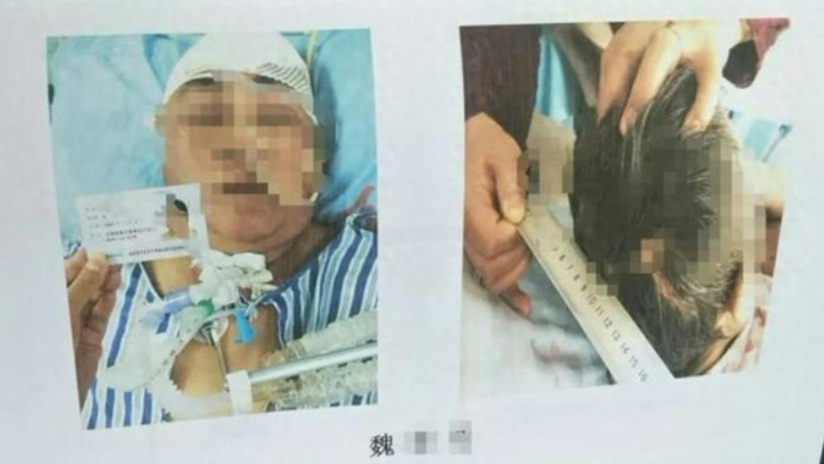 兄妹的母親被撞後傷勢嚴重。（圖／翻攝自微博）
