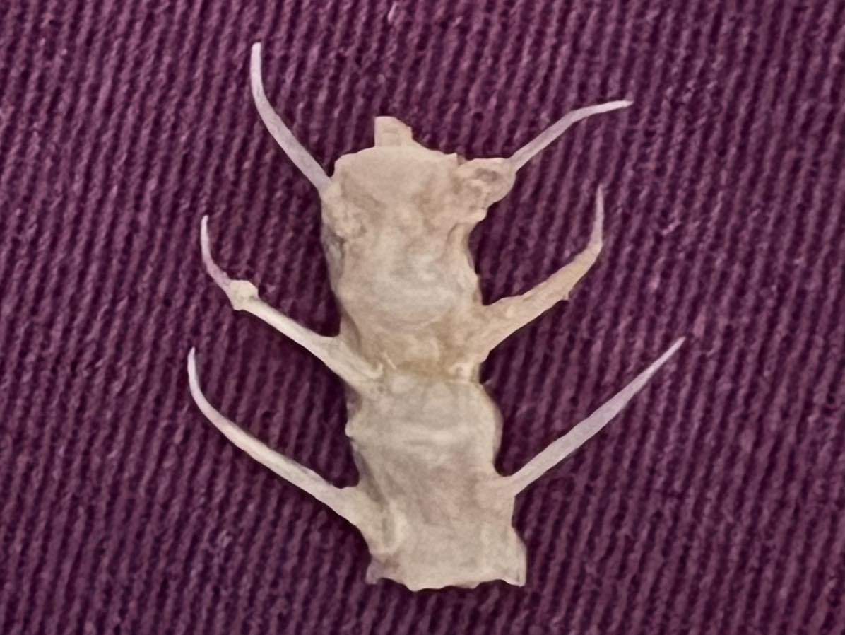 李柏賢醫師從患者喉嚨夾出超大根魚刺。（圖／翻攝自「Dr.Le 李柏賢」臉書）