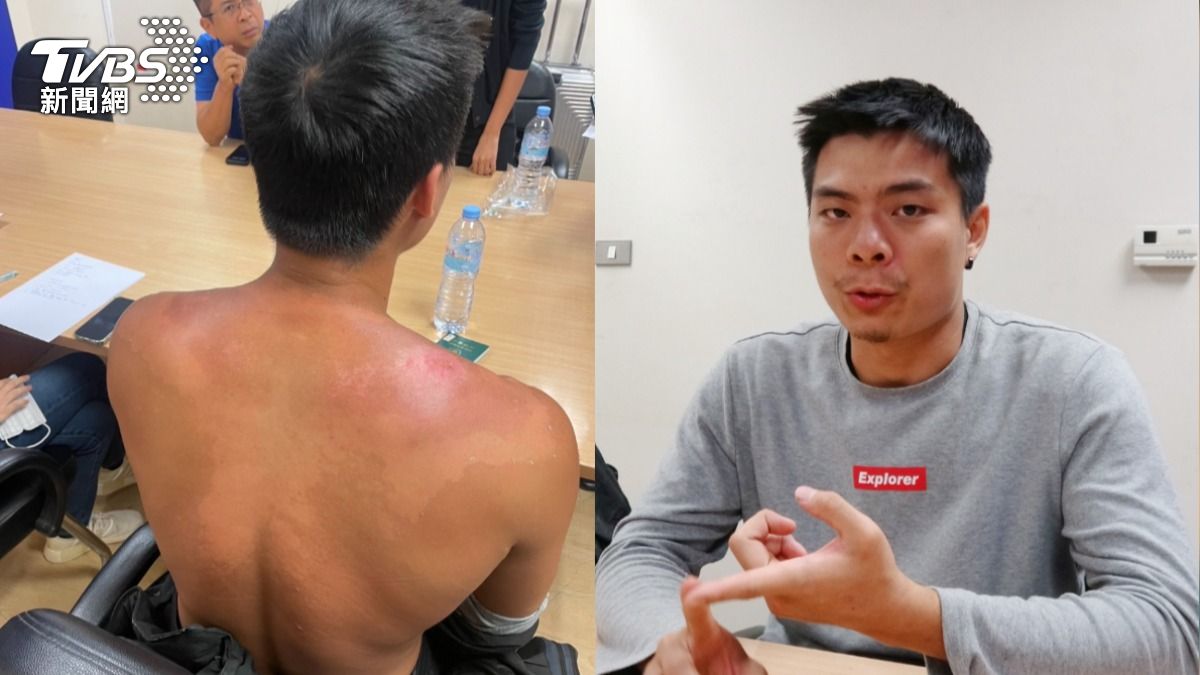 台灣火舞表演者謝岳鵬被騙到緬甸詐騙園區遭囚禁虐打，今日終於平安返台。（圖／中央社）