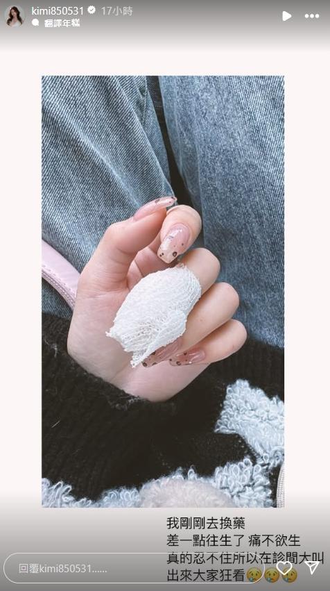 禾羽手指纏繞著紗布繃帶。（圖／翻攝自禾羽 IG）