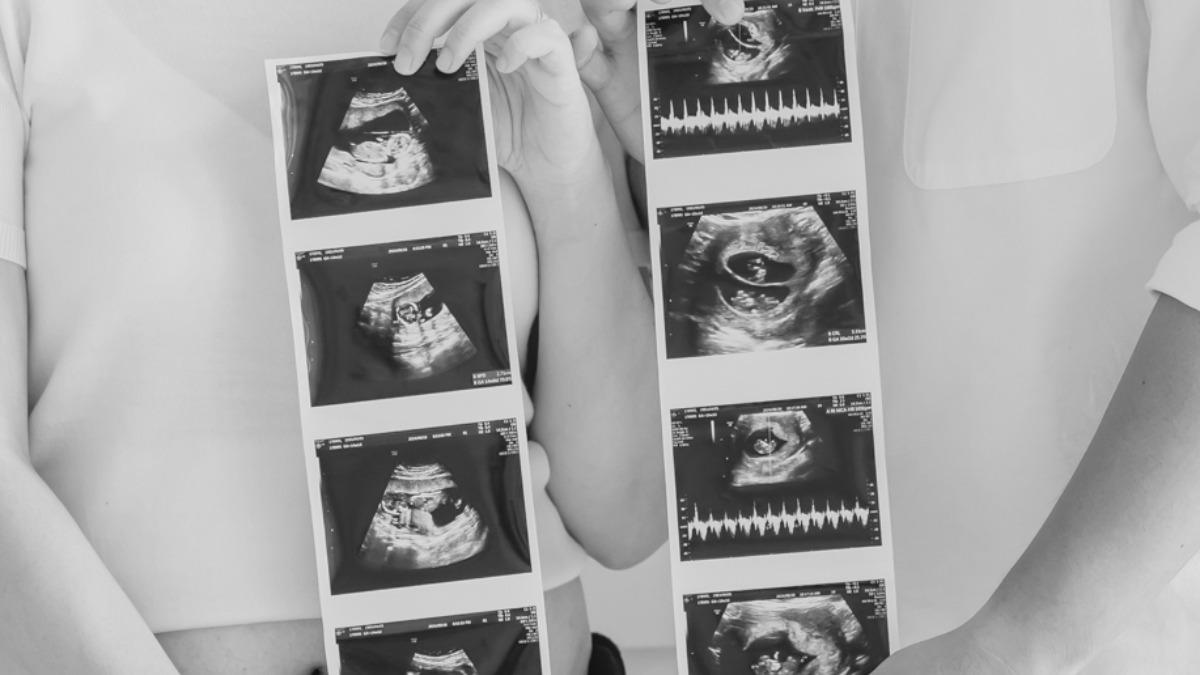 阿倫發出女兒們的超音波照心碎道別。（圖／翻攝自臉書）