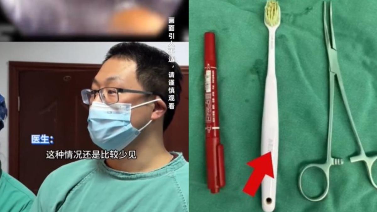 醫生取出牙刷很震驚。（圖／翻攝自微博《新浪新聞》）