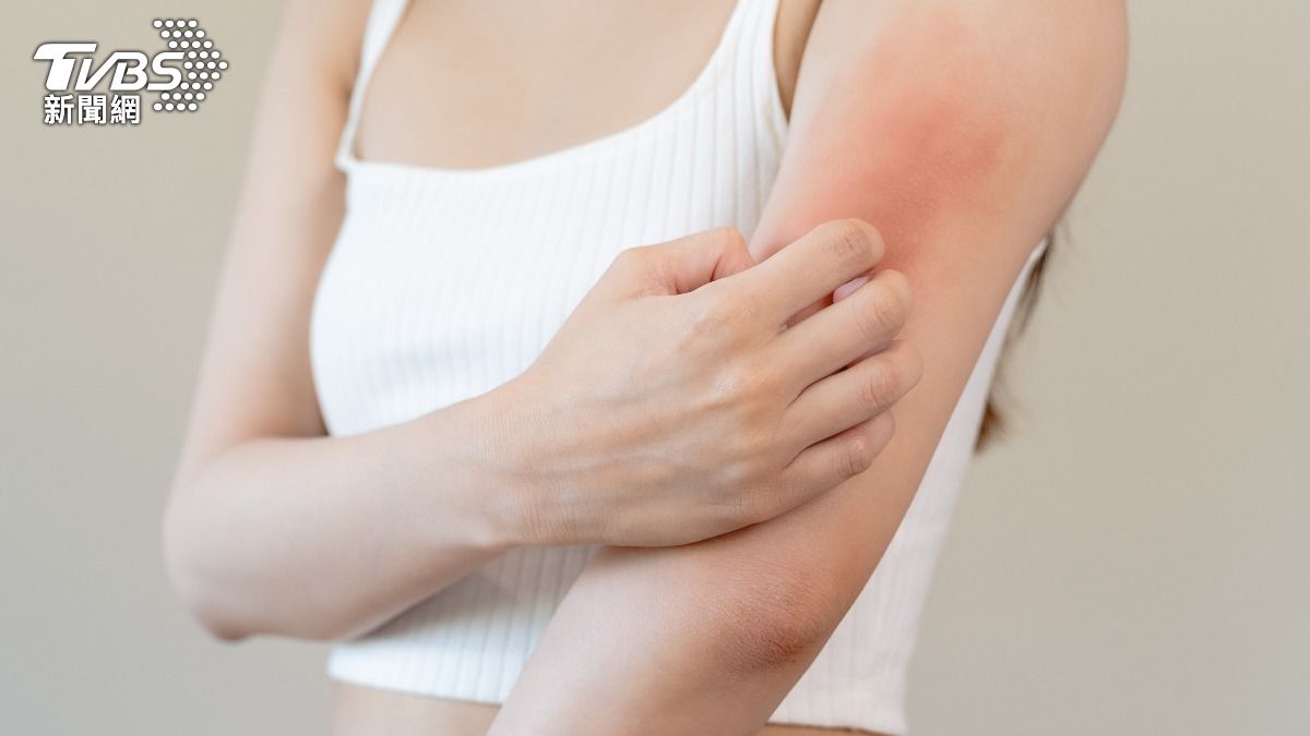 皮膚癢竟「罹患淋巴癌」!醫示警6症狀 夜間盜汗也危險