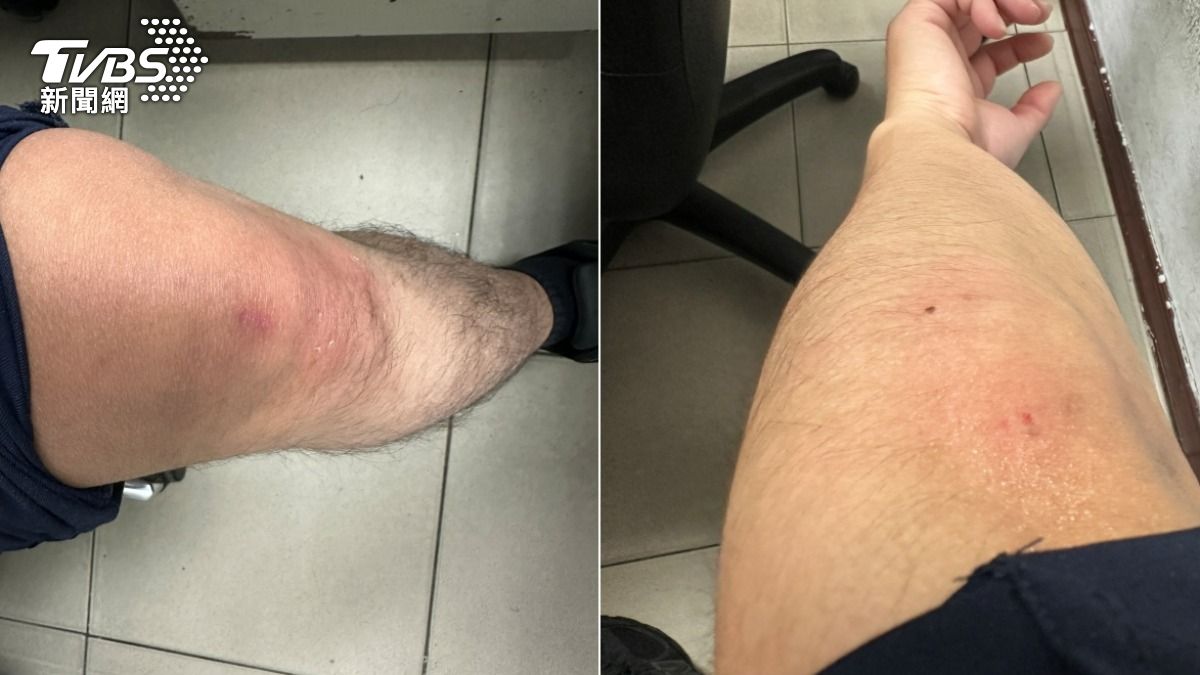 楊男激烈反抗，造成員警全身多處擦挫傷。（圖／TVBS）