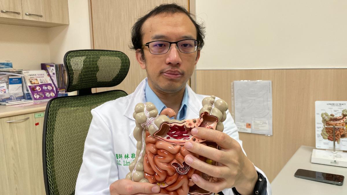 林敬淳解釋，憩室炎常被誤以為是腸胃炎。（圖／亞大附醫提供）