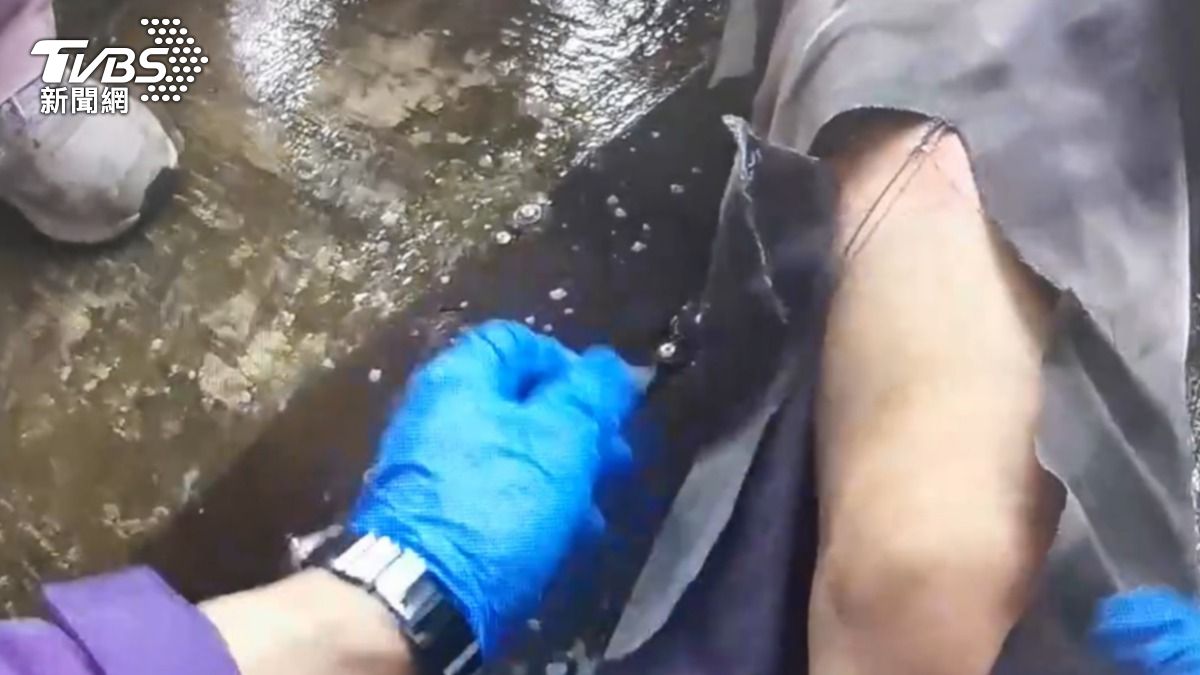 洗車的員工右小腿變形、右大腿擦傷。（圖／TVBS）