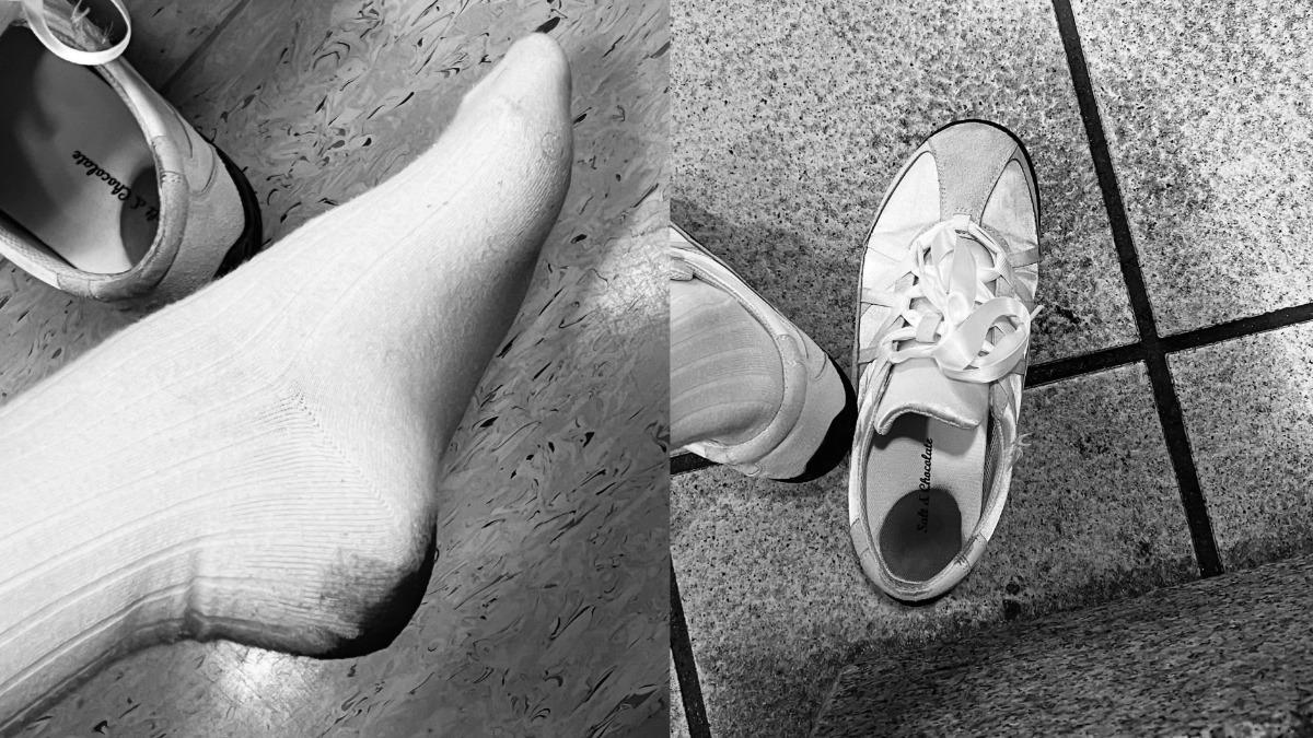 傷勢照片。（圖／翻攝自冼迪琦Threads）