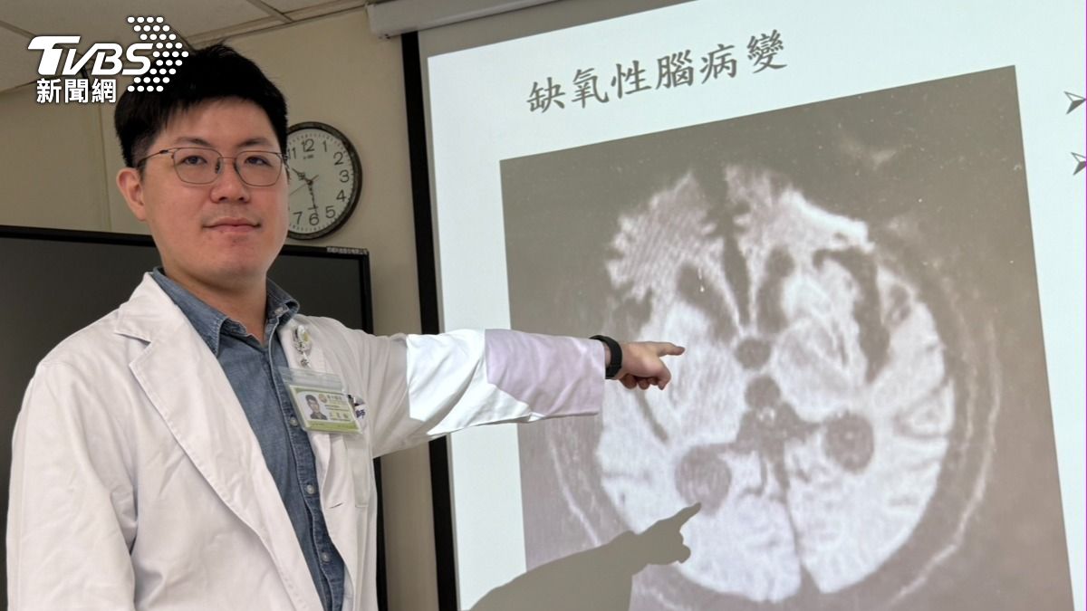 王星翰醫師解說。（圖／TVBS）