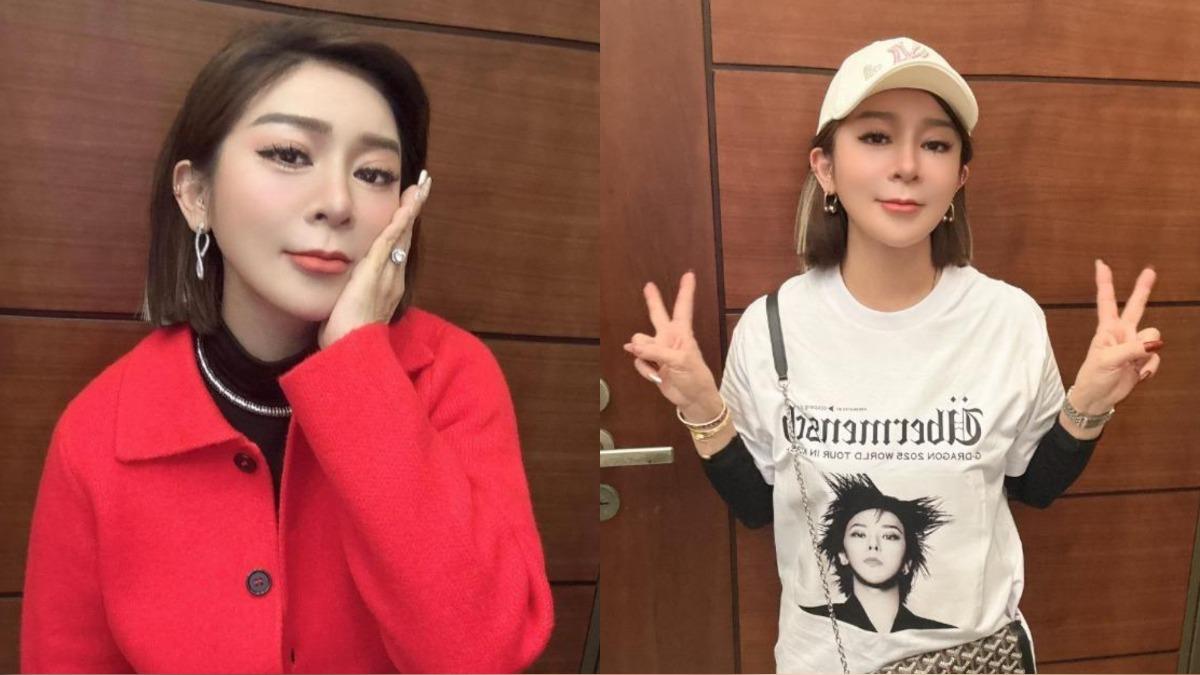 王彩樺大方承認自己有微整型。（圖／翻攝自王彩樺臉書）