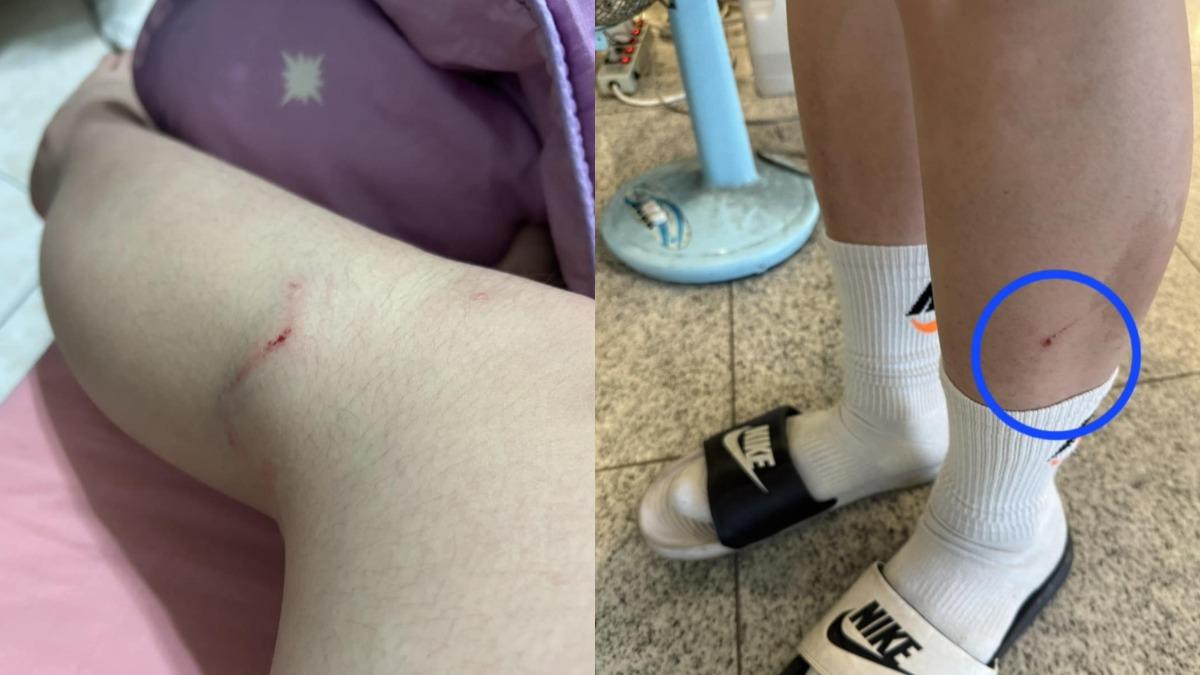 民眾遭流浪狗群咬傷。(圖/民眾提供)