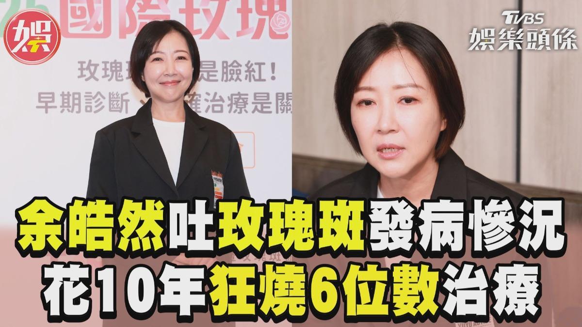 余皓然 影音／余皓然吐昔玫瑰斑發病慘況花費10年「狂燒6位數」治療│TVBS新聞網