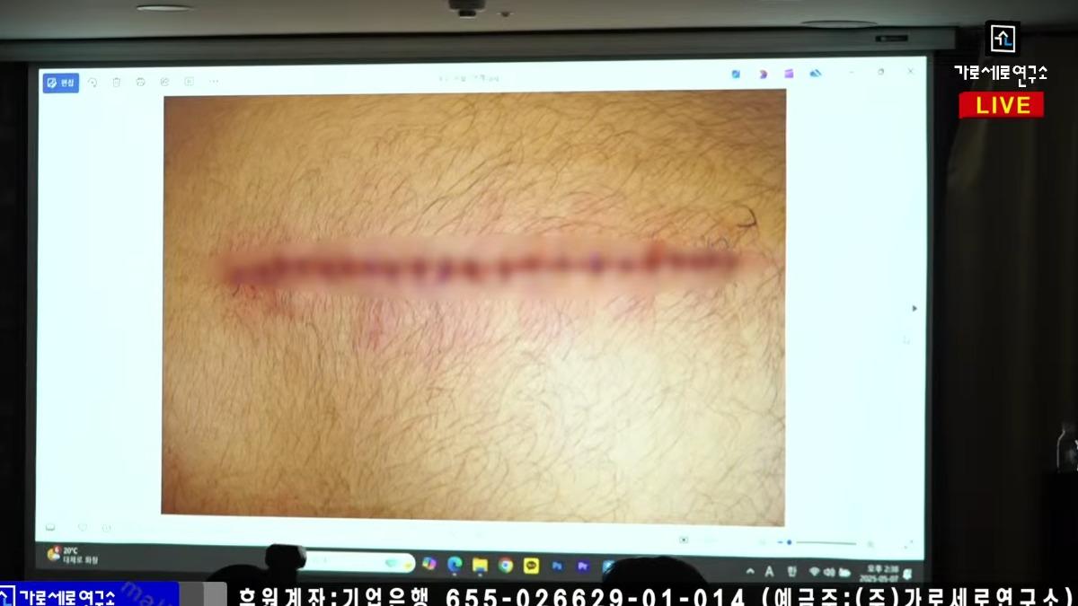 李鎮浩提出橫豎曬出的證人遭刺照,是圖庫舊照。(圖/翻攝自橫豎研究所YT)