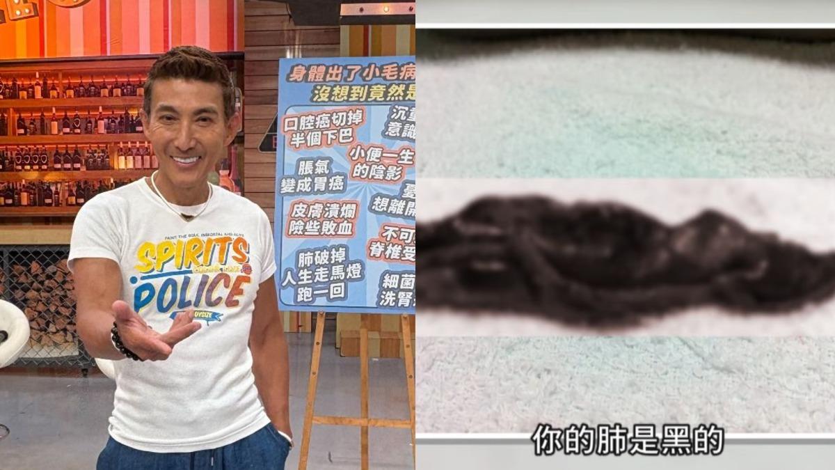 潘若迪曾氣胸動刀。（圖／TVBS）