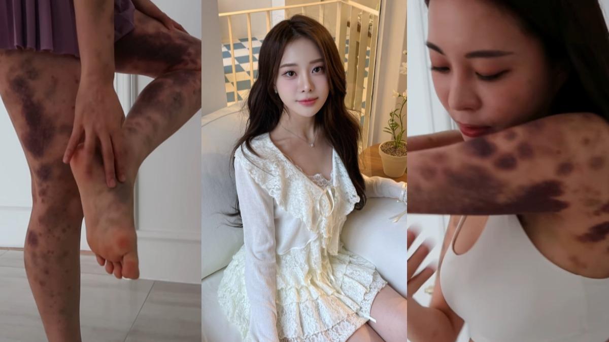 韓國網紅AORI分享自己慘痛的醫療糾紛。（圖／翻攝自aori YouTube、minyoung_aori IG）