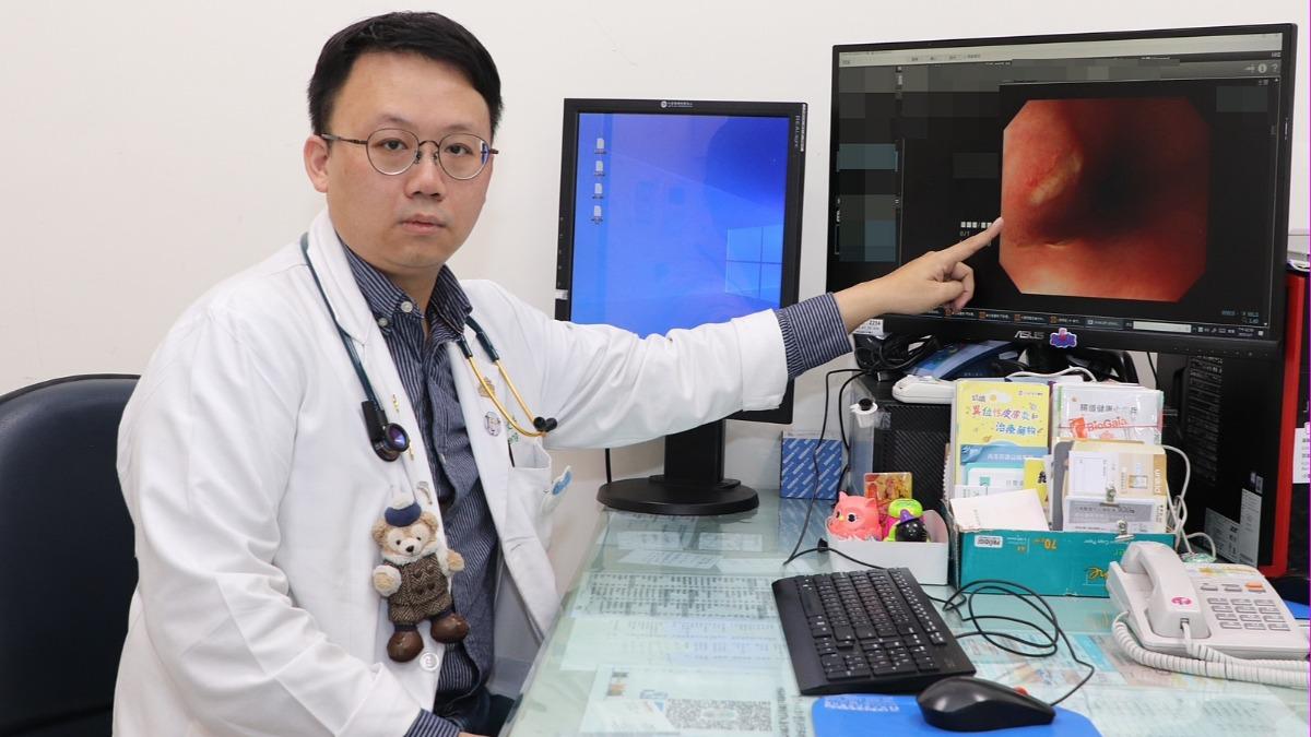 曾文禹解釋，錠劑與膠囊較容易附著在食道上，時間久了造成發炎，或是藥物溶解後直接灼傷食道。（圖／大里仁愛醫院）