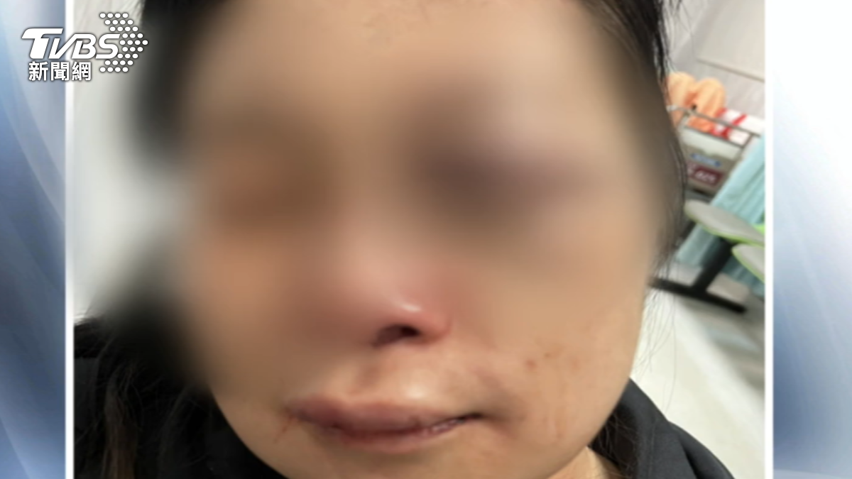 闖診所討債！牙醫師控靜安會恐嚇　錄音檔曝
