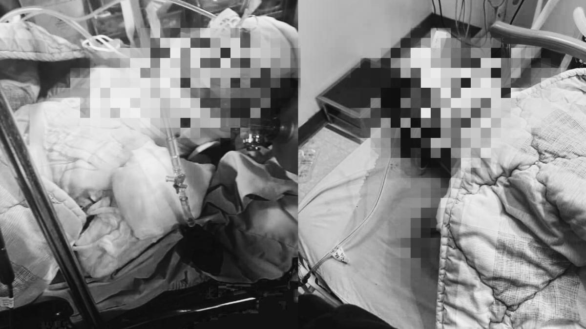 被撞男子身受重傷，仍在加護病房治療。（圖／家屬提供）