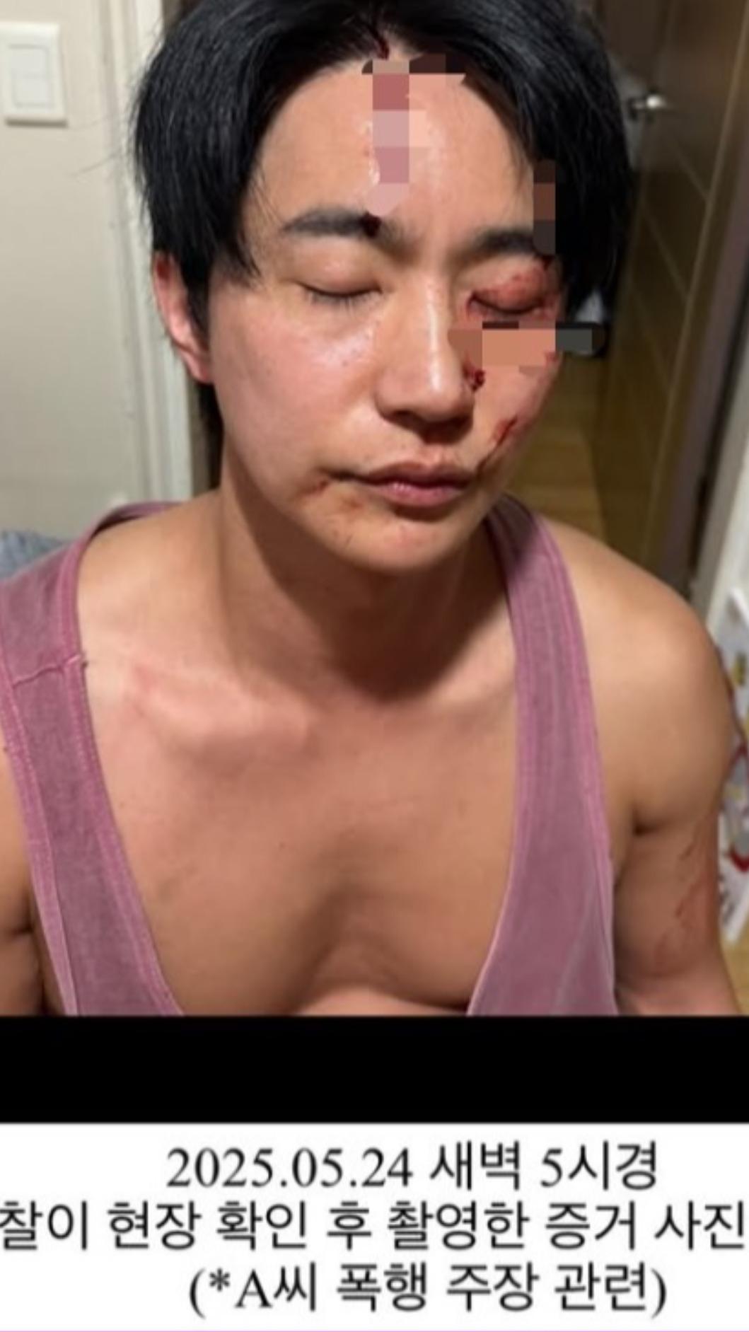 全浩俊曬出鼻青臉腫流血照，表示自己是正當防衛。（圖／翻攝自全浩俊IG）