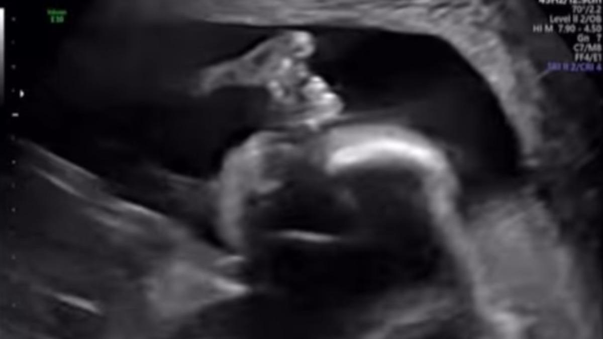 林正姬公開超音波照。（圖／翻攝自 IG soul_diva_jlim）