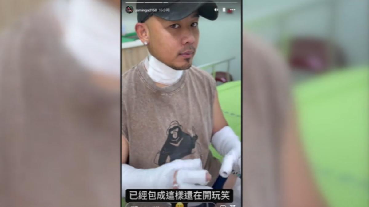 台東賣燒酒雞氣爆！　紀曉君夫炸傷　瓦斯爐「熄火漏氣」釀災