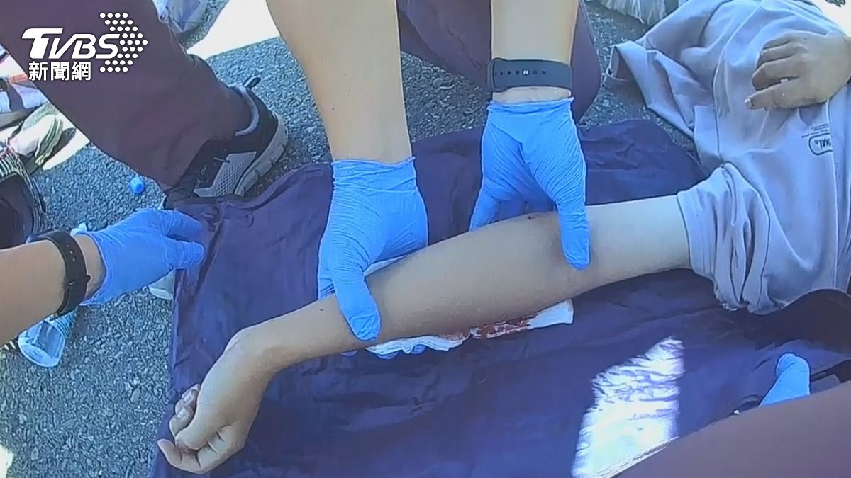 騎士雙手痛變形骨折。（圖／TVBS）
