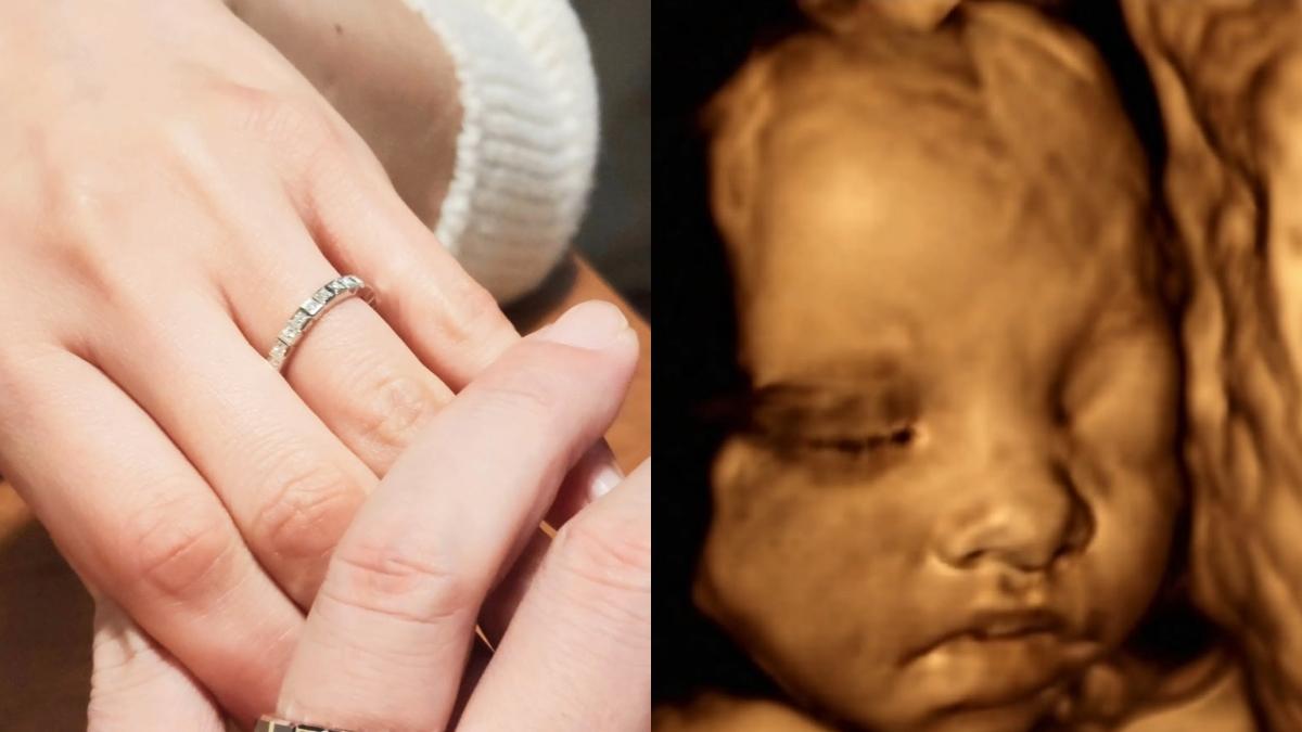 安詩荷分享了婚戒的照片跟寶寶的超音波照。（圖／翻攝自安詩荷IG）