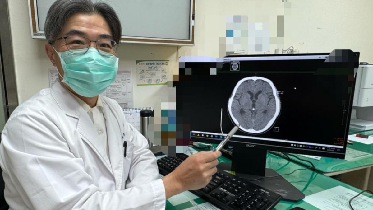 廖益聖提醒,頭暈、噁心、手腳無力、語言不清或臉部不對稱,都有可能是高溫腦中風。(圖/豐原醫院提供)