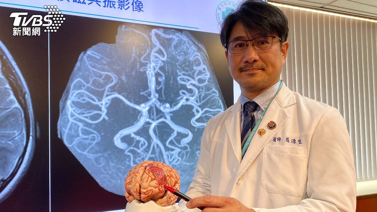 臺中榮總神經醫學中心介入性腦血管外科主任崔源生說明。(圖/TVBS)
