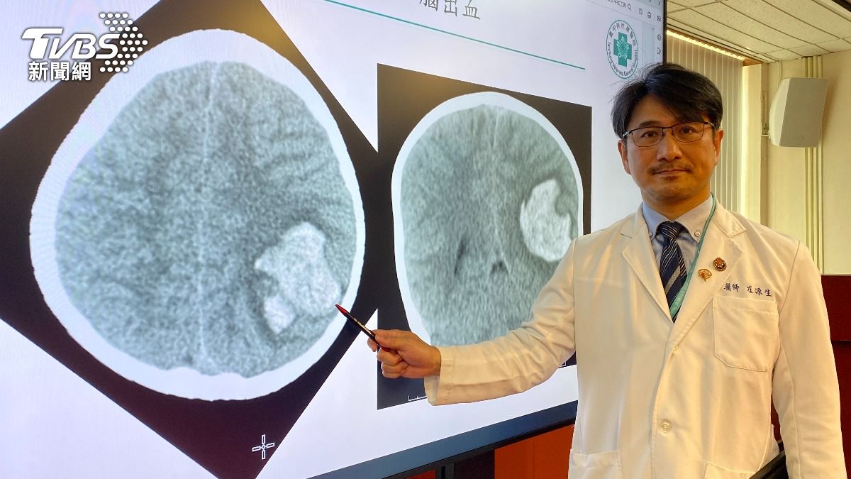 4歲男童到院時,腦動靜脈畸形合併有腦出血情形。(圖/TVBS)