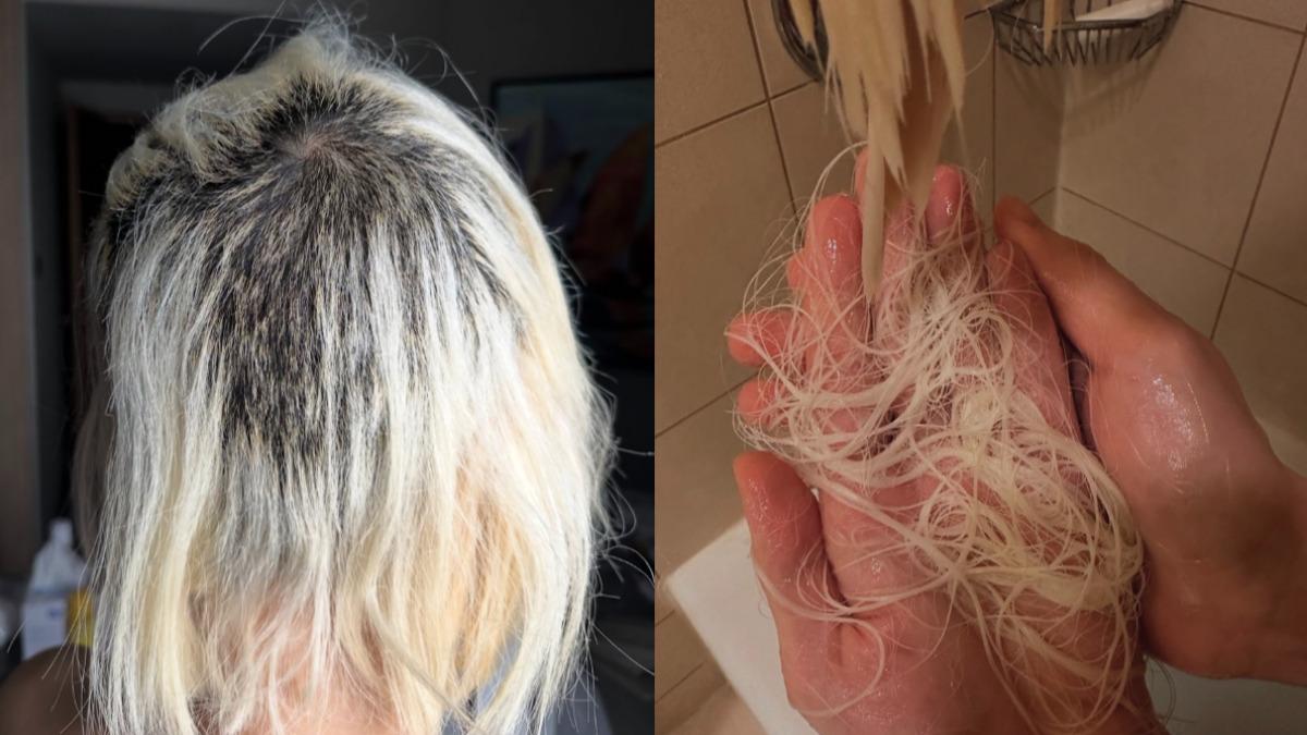 DJ SODA因漂髮導致髮根損壞，頭髮不停掉落。（圖／翻攝自DJ SODA IG）