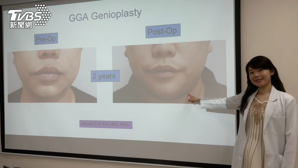 季照芸診斷，陳男下巴內縮，造成呼吸道較正常人狹窄，是釀病主因。（圖／林冠丞攝）