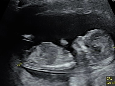 吳怡萱透露已懷孕4個月。（圖／翻攝自吳怡萱臉書）