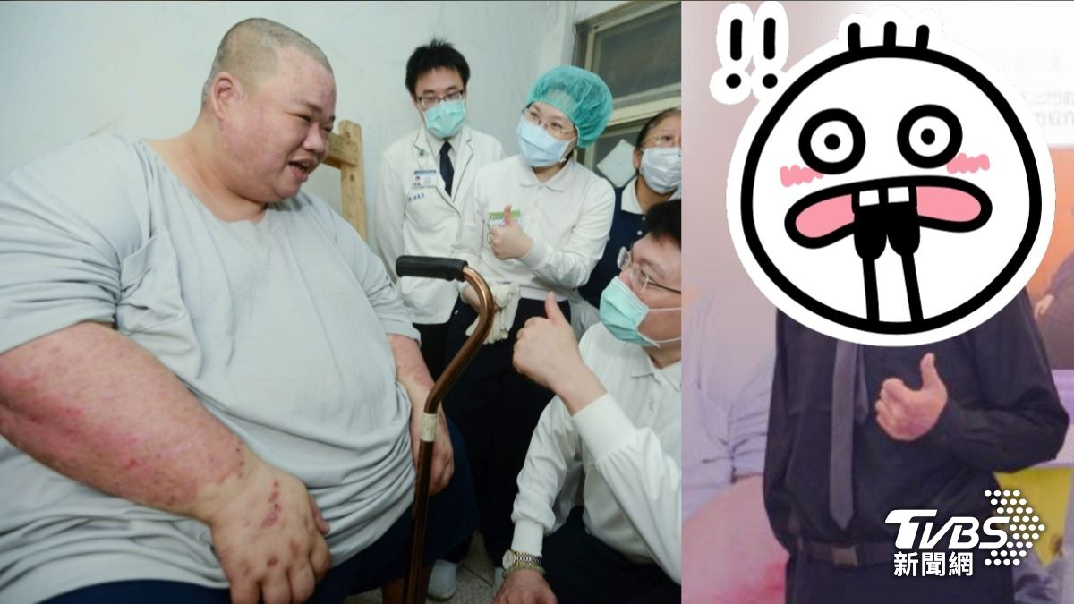 吳先生消風200公斤成果豐碩，減肥前後判若兩人。（圖／台北慈濟醫院）