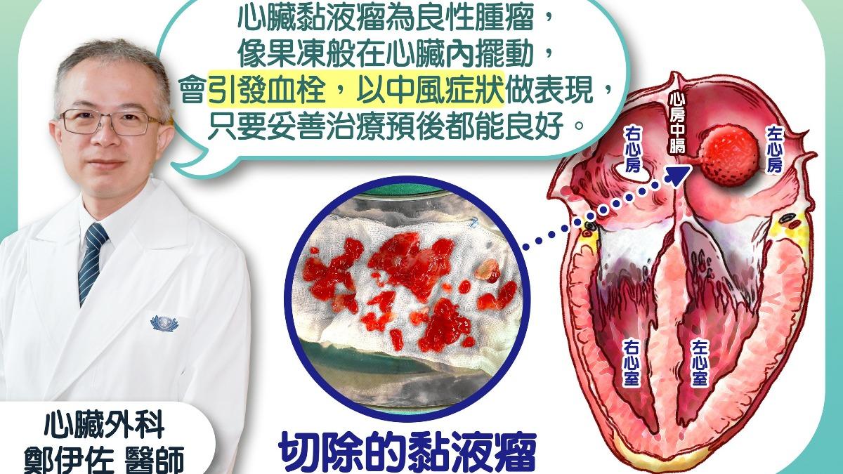 心臟黏液瘤是心臟內最常見的原發性良性腫瘤，約八成生長於左心房。（圖／慈濟醫院提供）