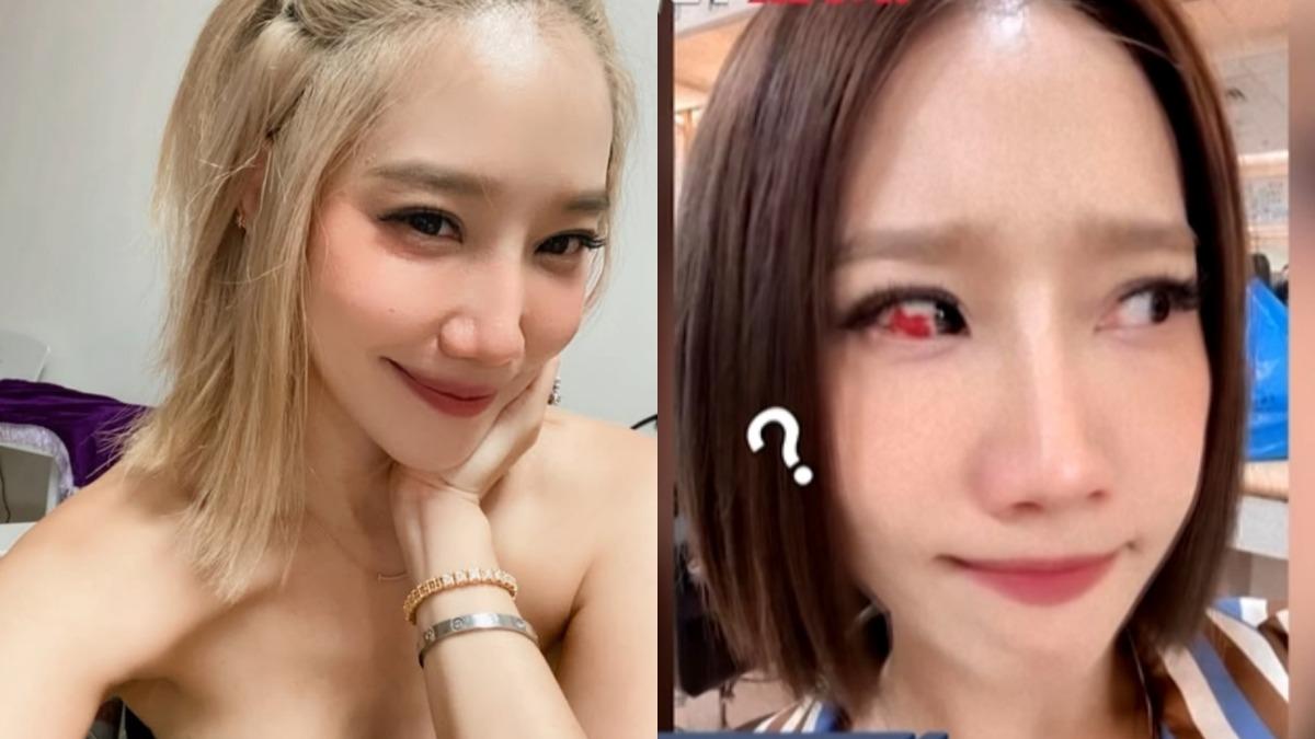楊皓如分享健康狀況。（圖／翻攝楊皓如IG、醫師好辣YouTube）