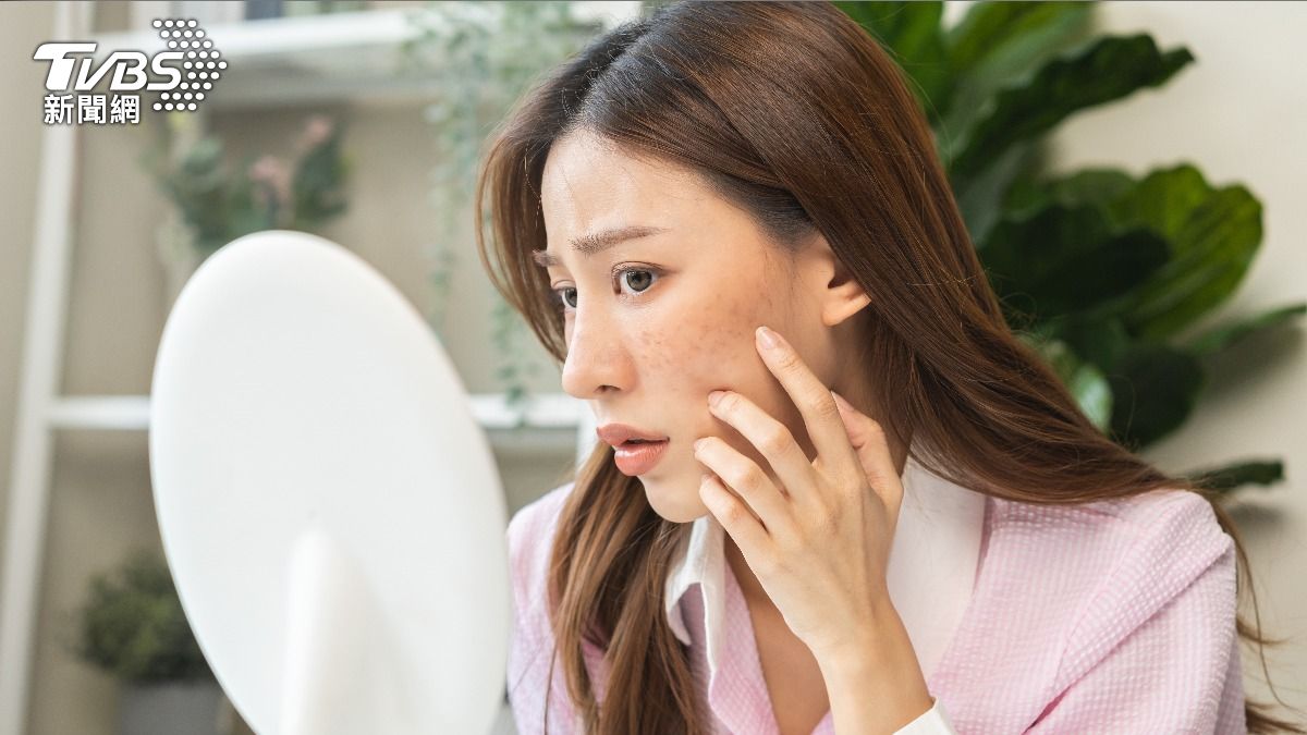 狂冒痘痘超困擾！「5大習慣」超容易踩雷　快檢查中了幾項