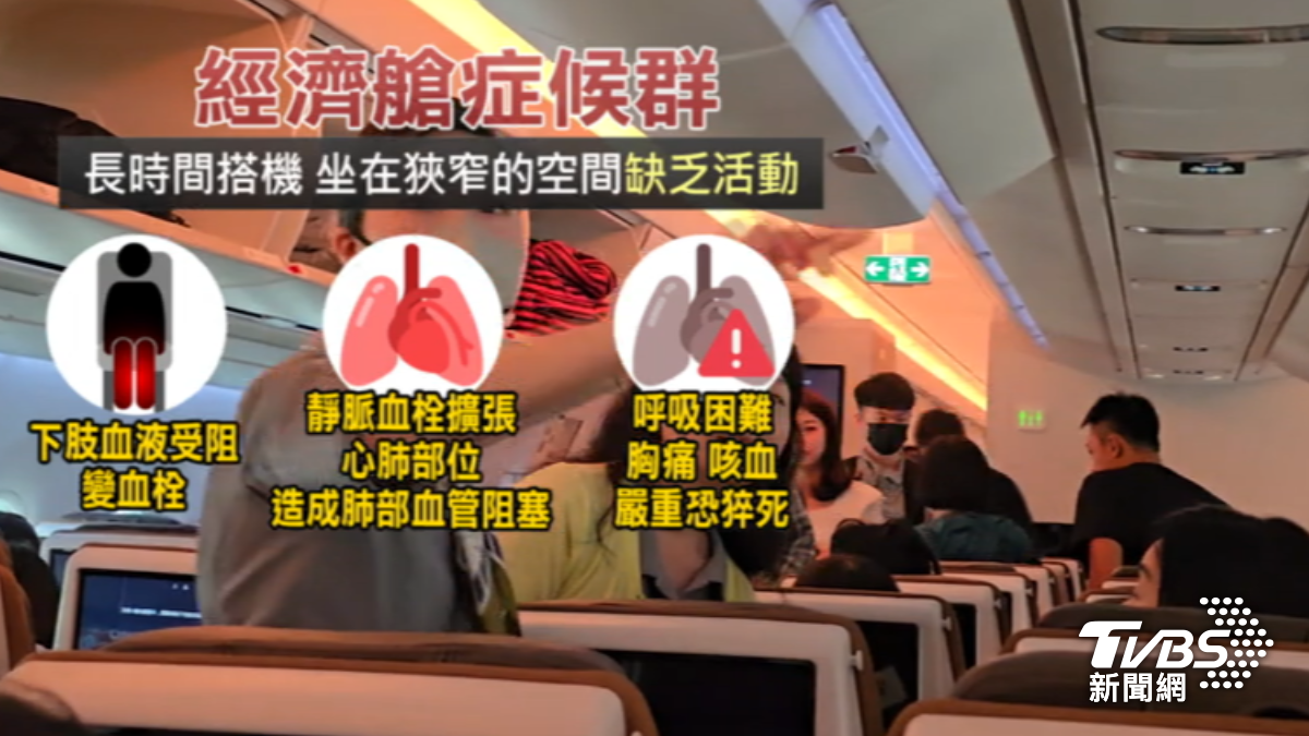 機上久坐恐釀血栓！醫：「這些人」搭機需特別注意