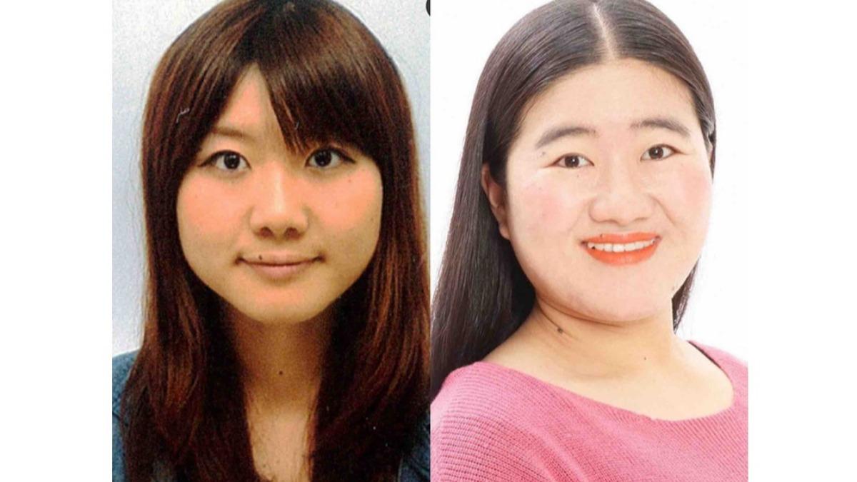 經紀人1句話救命！日女星「四肢、鼻子變大」　竟是罹罕見腫瘤