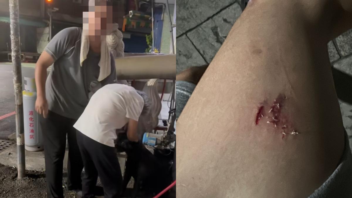 男遇同條瘋狗攻擊！腿噴血皮開肉綻　飼主：咬人是牠自由