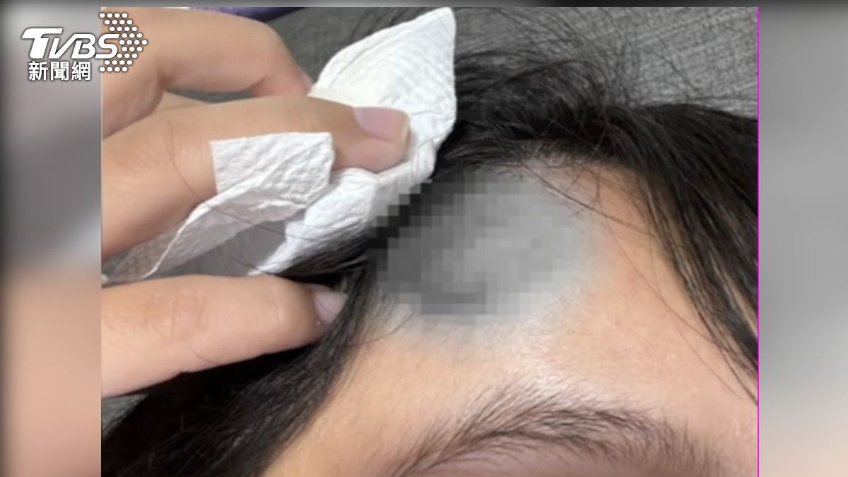 獨／「不分手」！軍人男友施暴又情勒　糾纏兩年