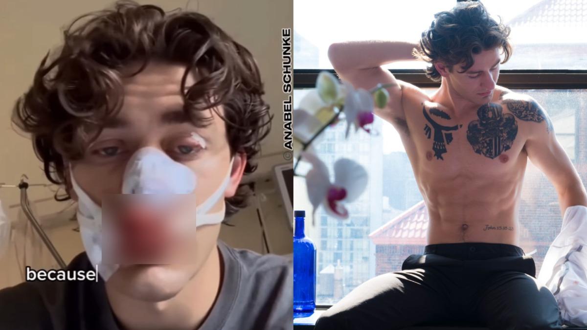 美國21歲模特魯達近日遊德，為保護兩名婦女遭刺傷。(圖／翻攝自IG@john.rudat)