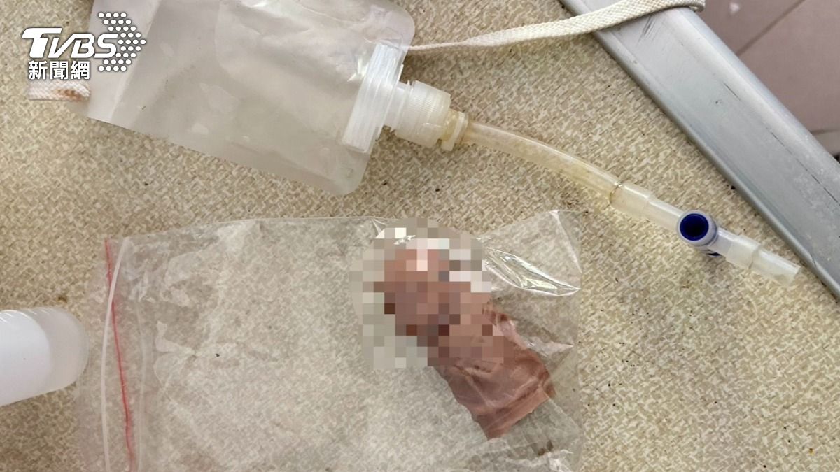 北投4毒蟲工地竊電纜　他假陽具藏尿液騙檢驗