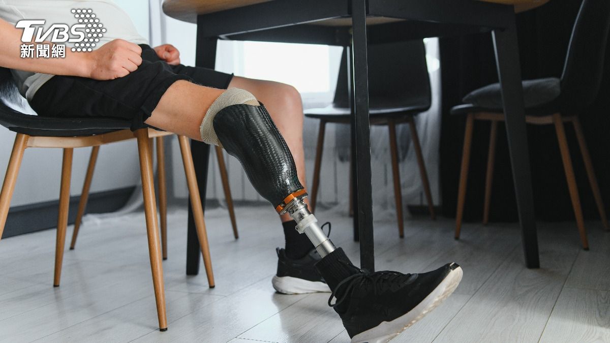 父親罹糖尿病截肢！親友勸「帶回斷腳」：人走的時候才算全屍