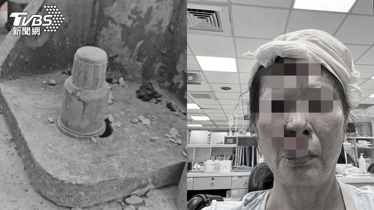苗栗縣竹南鎮一名婦人，跌到撞到路燈螺絲基座，臉嚴重受傷毀容。（圖／TVBS、民眾提供）