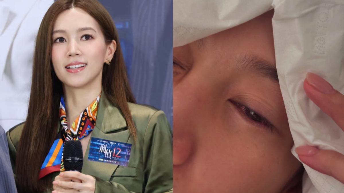香港女星傅嘉莉日前透露自己眼角膜受傷嚴重到送急診。（圖／翻攝自IG）