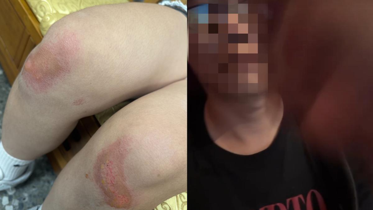 台中2少女看電影被扁到腦震盪！父親控影城裝死　秀泰回應了