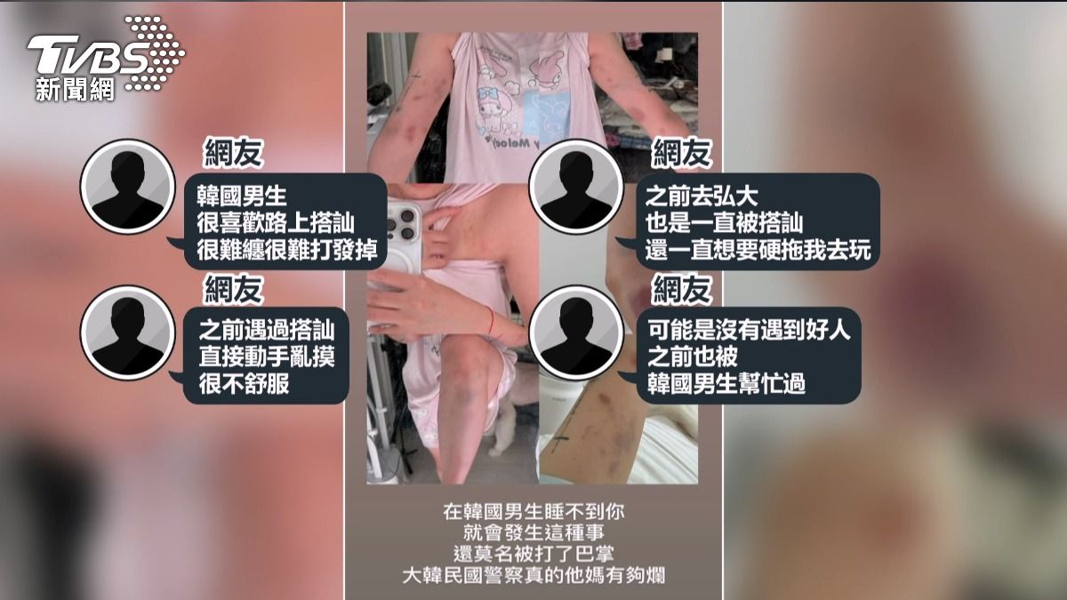 台YTR拒搭訕遭韓男毆打！全身瘀青手指骨折弘大搭訕施暴非首次│TVBS新聞網